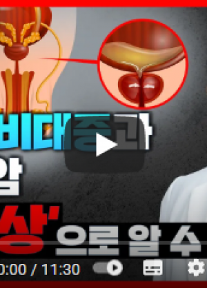 전립선질환총정리